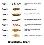 Constipation and how it affects colon function